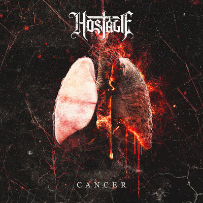 Cancer/HOSTAGE