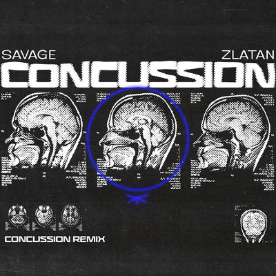Concussion (Remix)/Savage & Zlatan
