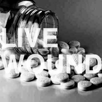 アルバム/Live Wound/Jesus Wound