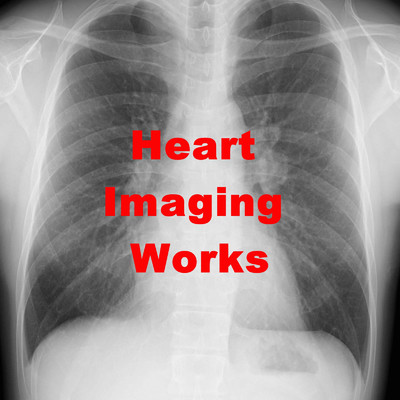 不敗者/Heart Imaging Works