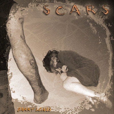Scars/Barry Lewis