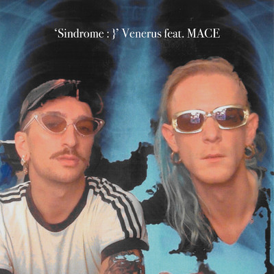 Sindrome/Venerus／MACE